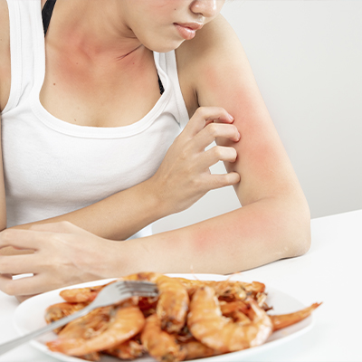 Alergias alimentarias